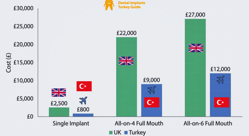 bar graph Dental Implant Prices in cities in United Kingdom vs Turkey